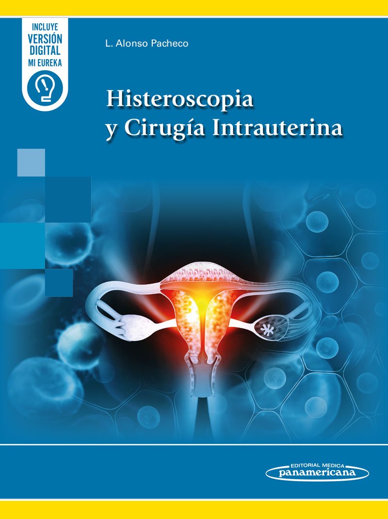 Cover 006 - Histeroscopia y Cirugía Intrauterina