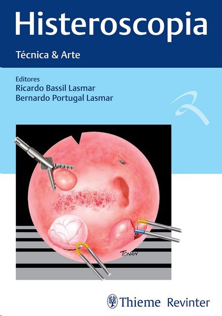 Cover 014 - Histeroscopia - Técnica e Arte