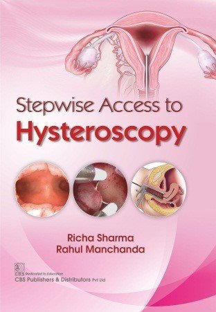 Cover 019 - Stepwise Access to Hysteroscopy