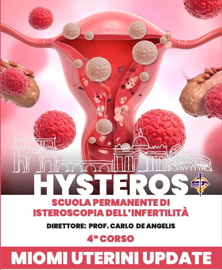Miomi Uterini Update e Scuola di Isteroscopia